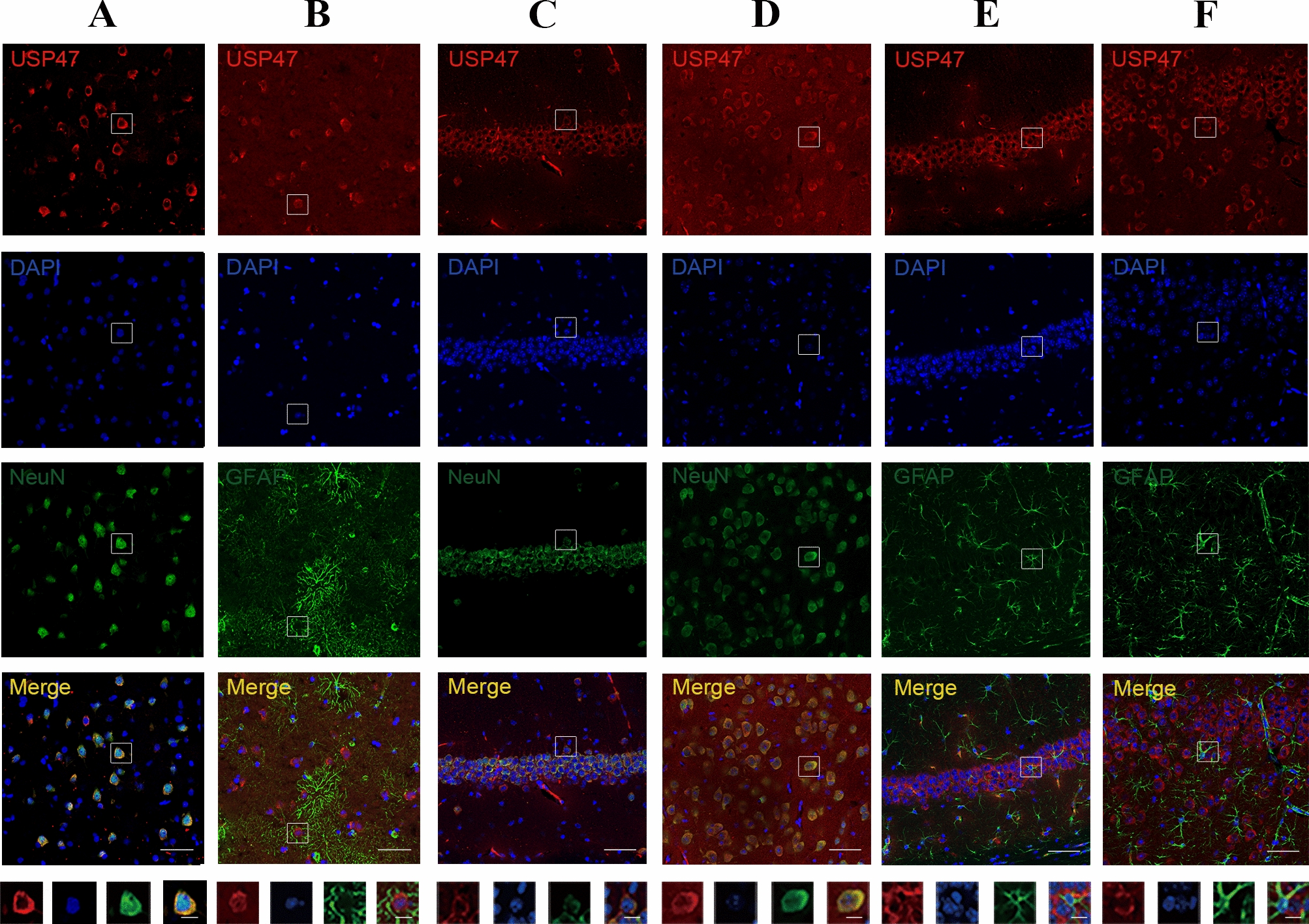 USP47 Regulates Excitatory Synaptic Plasticity and Modulates Seizures in Murine Models by Blocking Ubiquitinated AMPAR Degradation