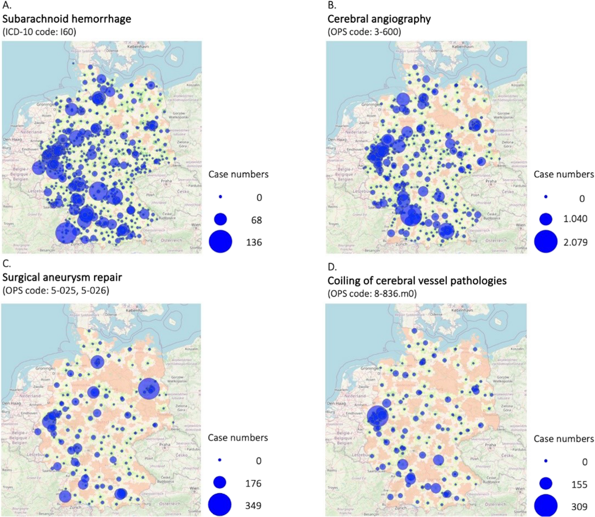 Geographical accessibility and case loads in subarachnoid hemorrhage care: a nationwide study of German hospitals