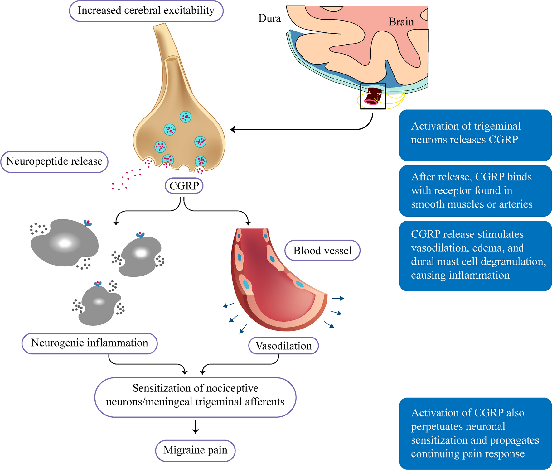 Gepants in Primary Care: A Targeted Approach to Acute and Preventive Treatment of Migraine
