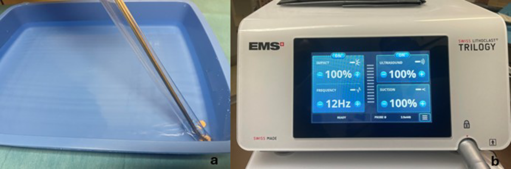 In vivo and in vitro evaluation of the Swiss LithoClast Trilogy Max Handpiece
