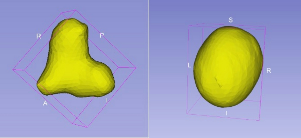 3D-printed artificial urinary stones reproducing human morphology: a novel laboratory model for endourology test and simulation