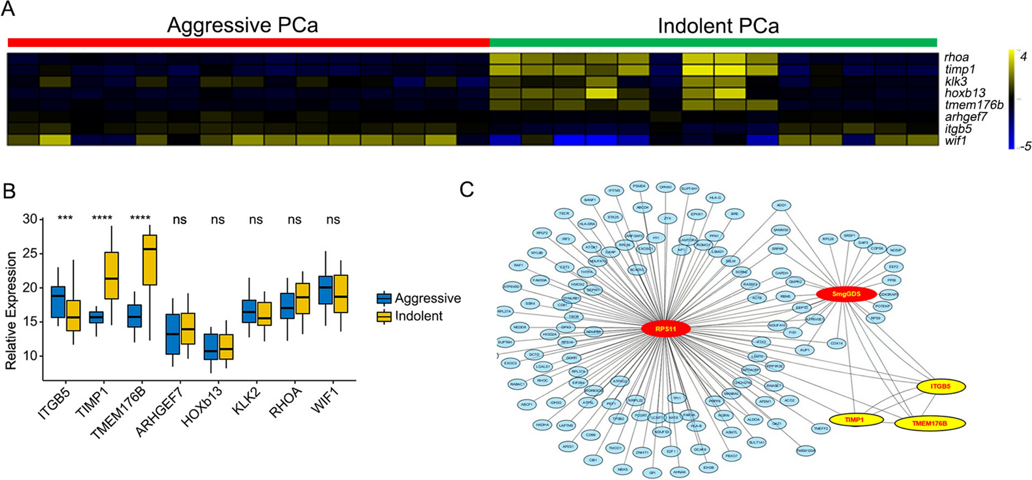 A secreted signature discriminates indolent from aggressive prostate tumors