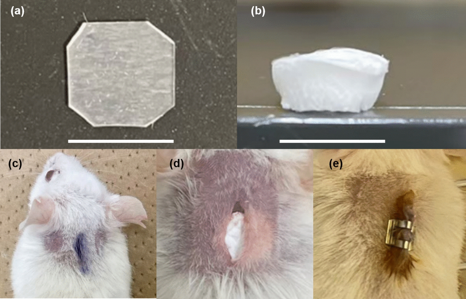 Sustained-release of 4-hydroxytamoxifen inhibits capsular contracture after breast implant placement in a mouse model