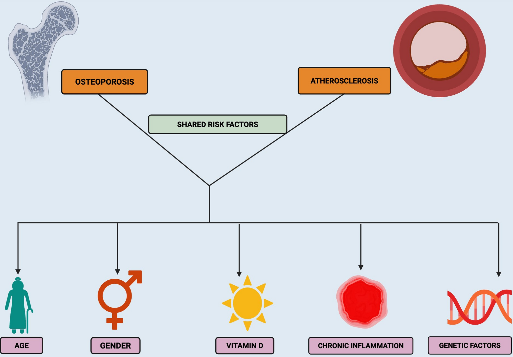 Bone and Cardiometabolic Connection: Crosstalk between Osteoporosis and Atherosclerosis