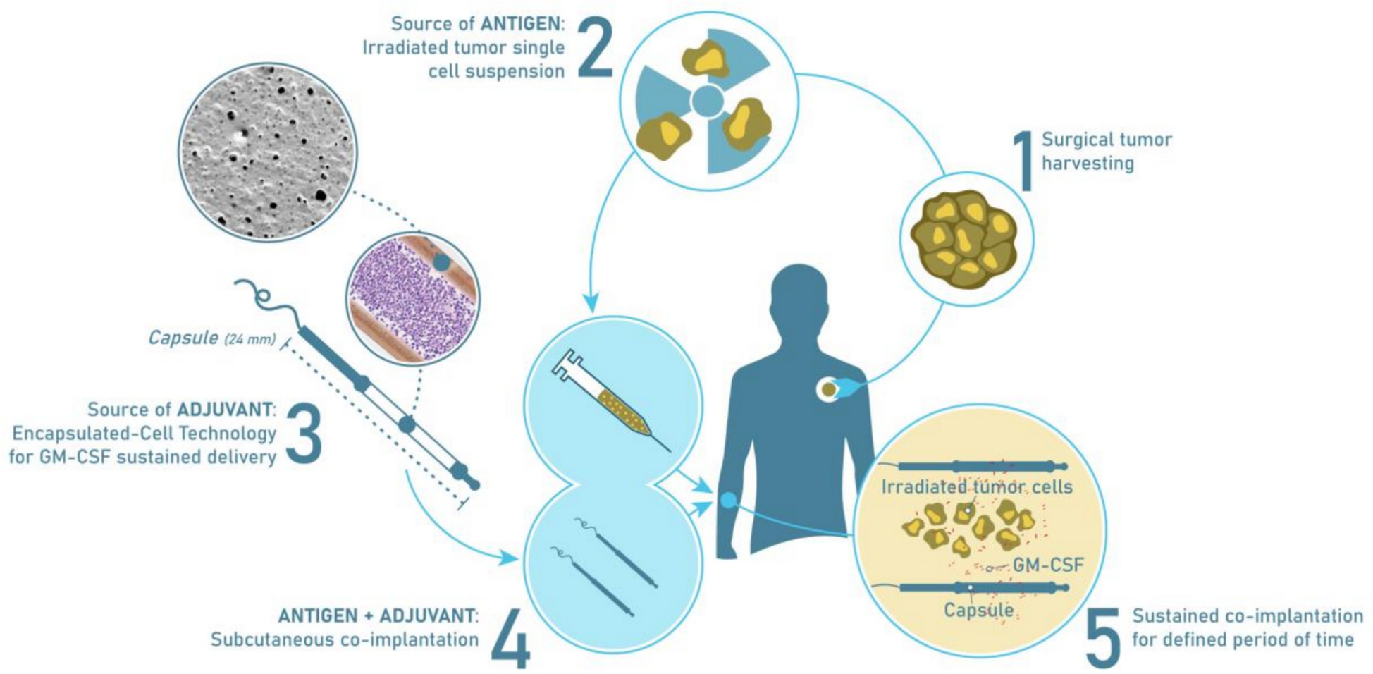 Overall survival of recurrent/metastatic head & neck squamous cell carcinoma patients progressing after ≥ 1 line of systemic therapy, treated with MVX-ONCO-1, a novel, first in class cell encapsulation-based immunotherapy: results of SAKK 11/16, a phase IIa trial