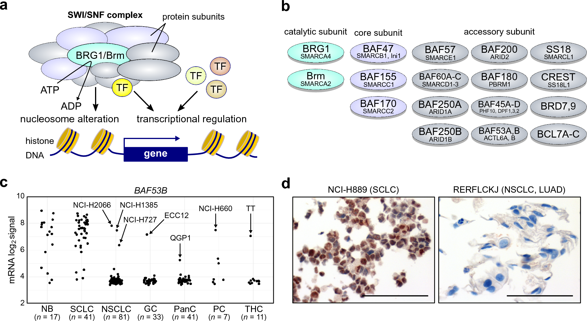 The SWI/SNF chromatin remodeling complex subunit BAF53B as an immunohistochemical marker for neuroendocrine neoplasms