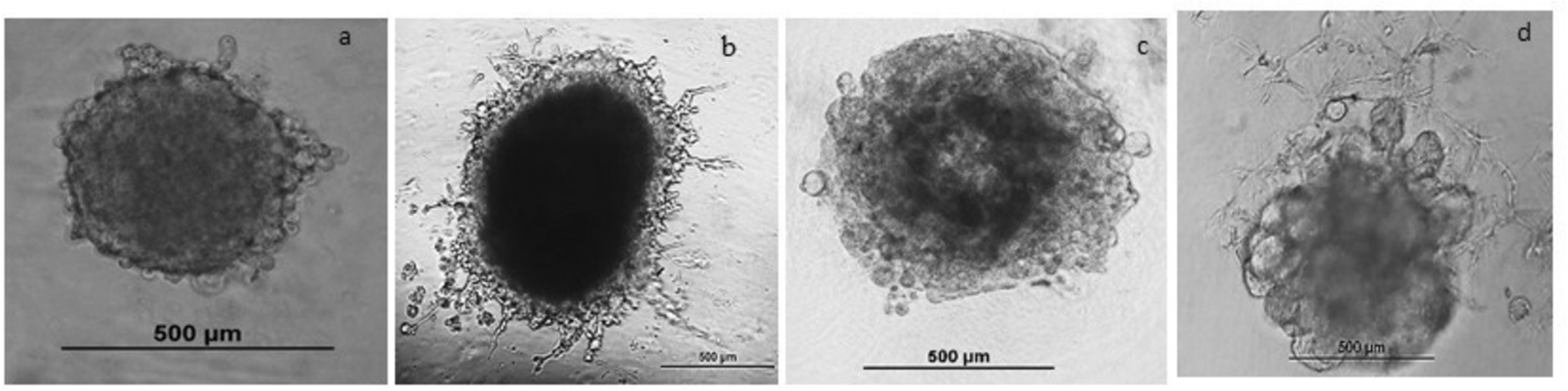 Simulating tumor complexity: 3D pancreatic tumor spheroid model for improved drug screening