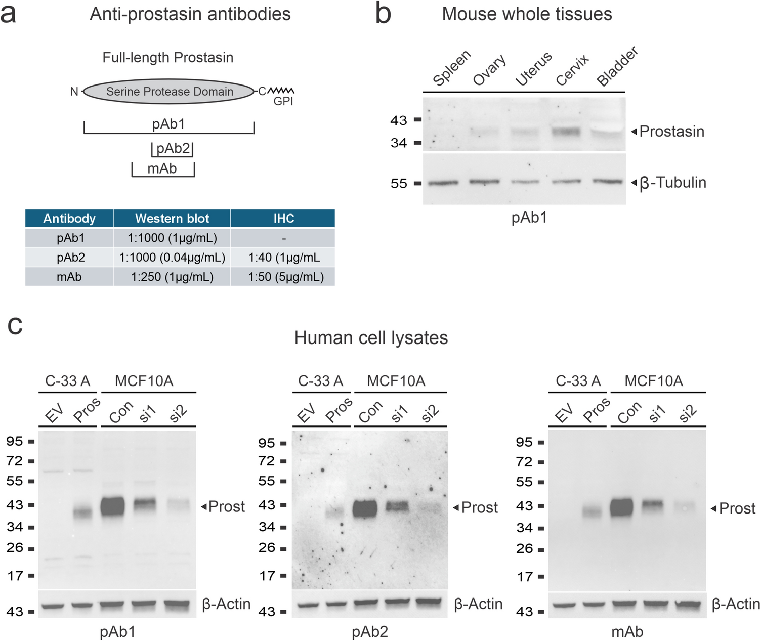 The cell-surface serine protease prostasin is lost during cervical squamous cell carcinogenesis