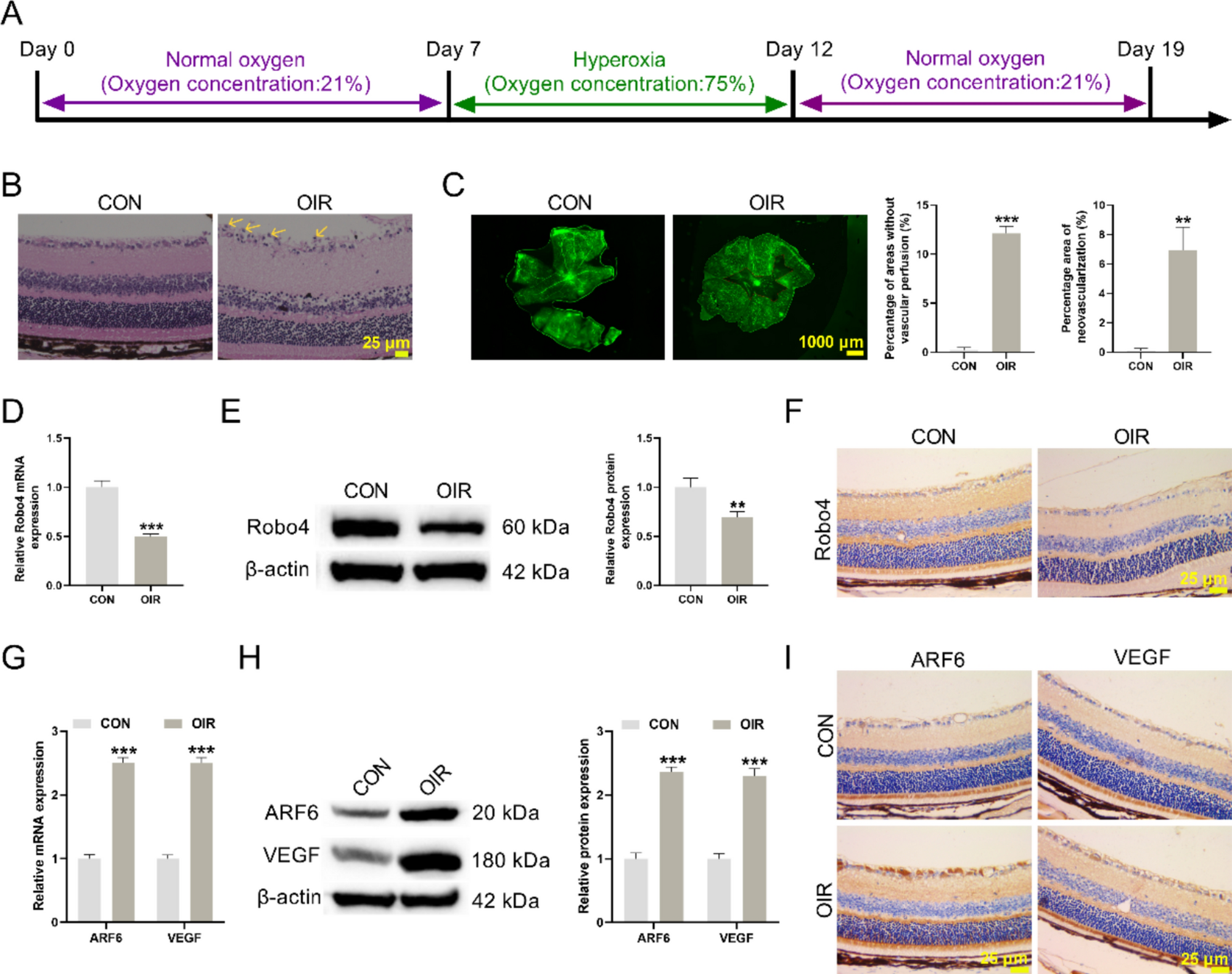 Robo4 inhibits neovascularization in oxygen-induced retinopathy by regulating ARF6 and VEGF