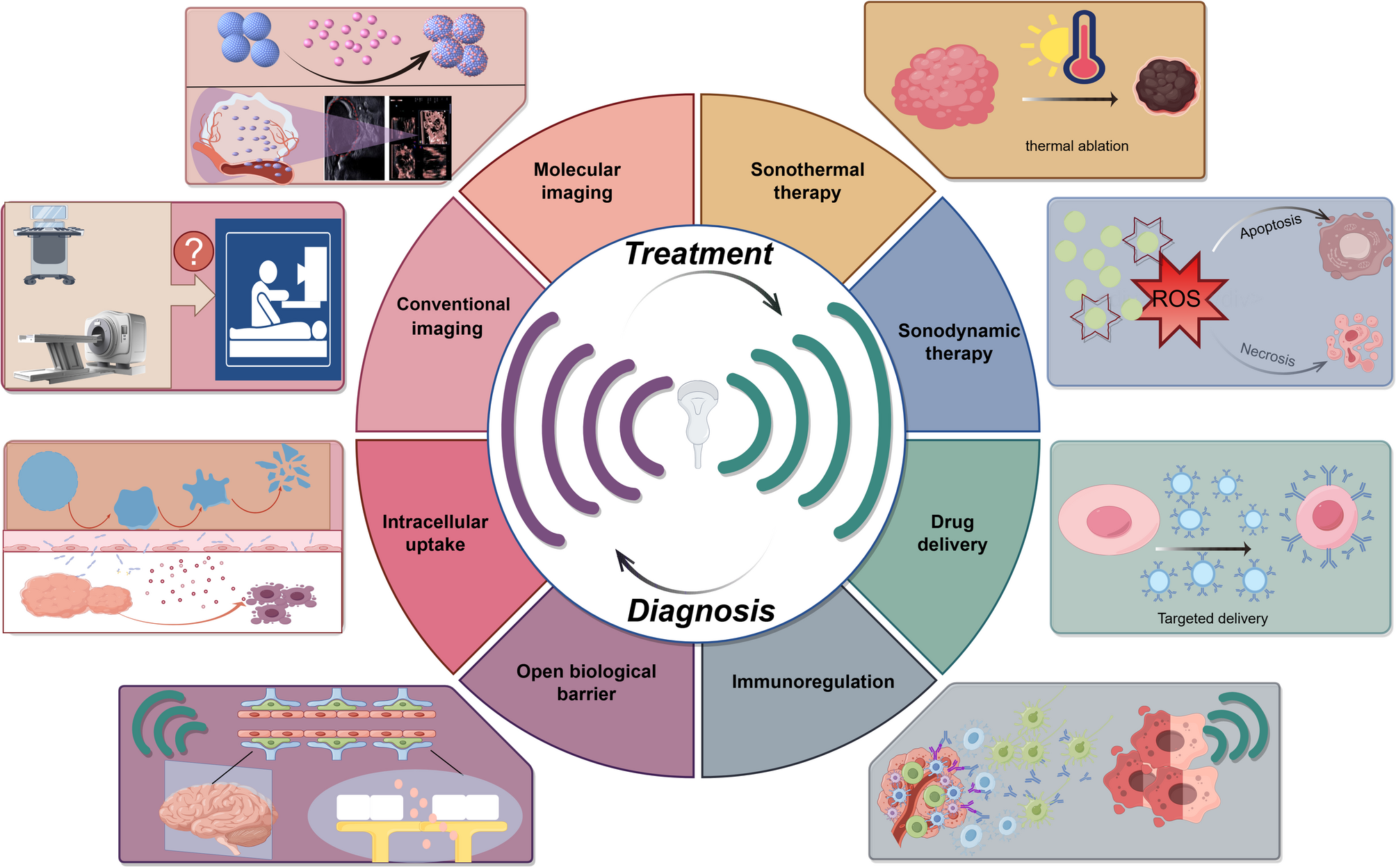 Advances and innovations in ultrasound-based tumor management: current applications and emerging directions