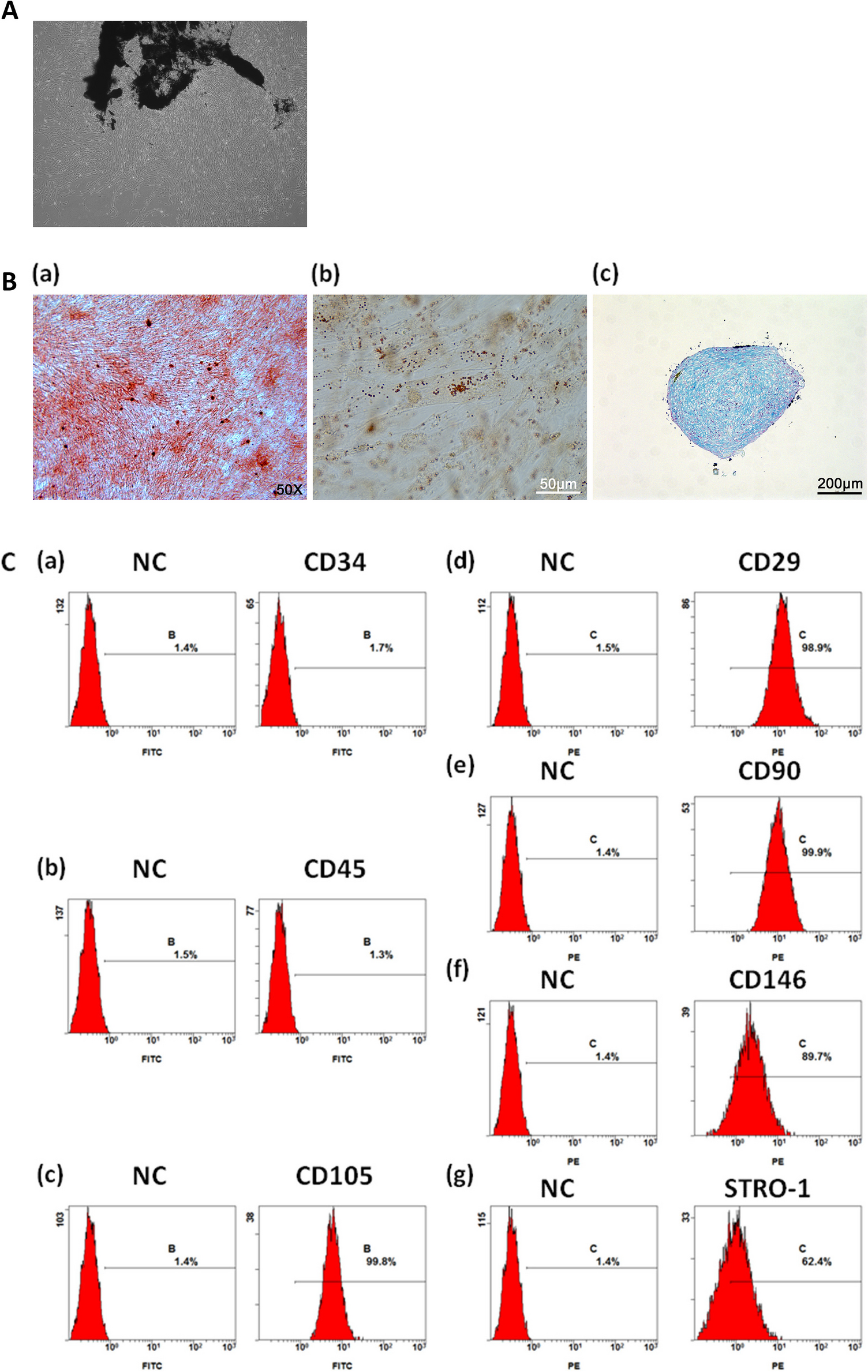 LncRNA TP53TG1 promotes the growth and osteo/dentinogenic differentiation of dental pulp stem cells by activating the Smad3 and JNK1/2 pathway