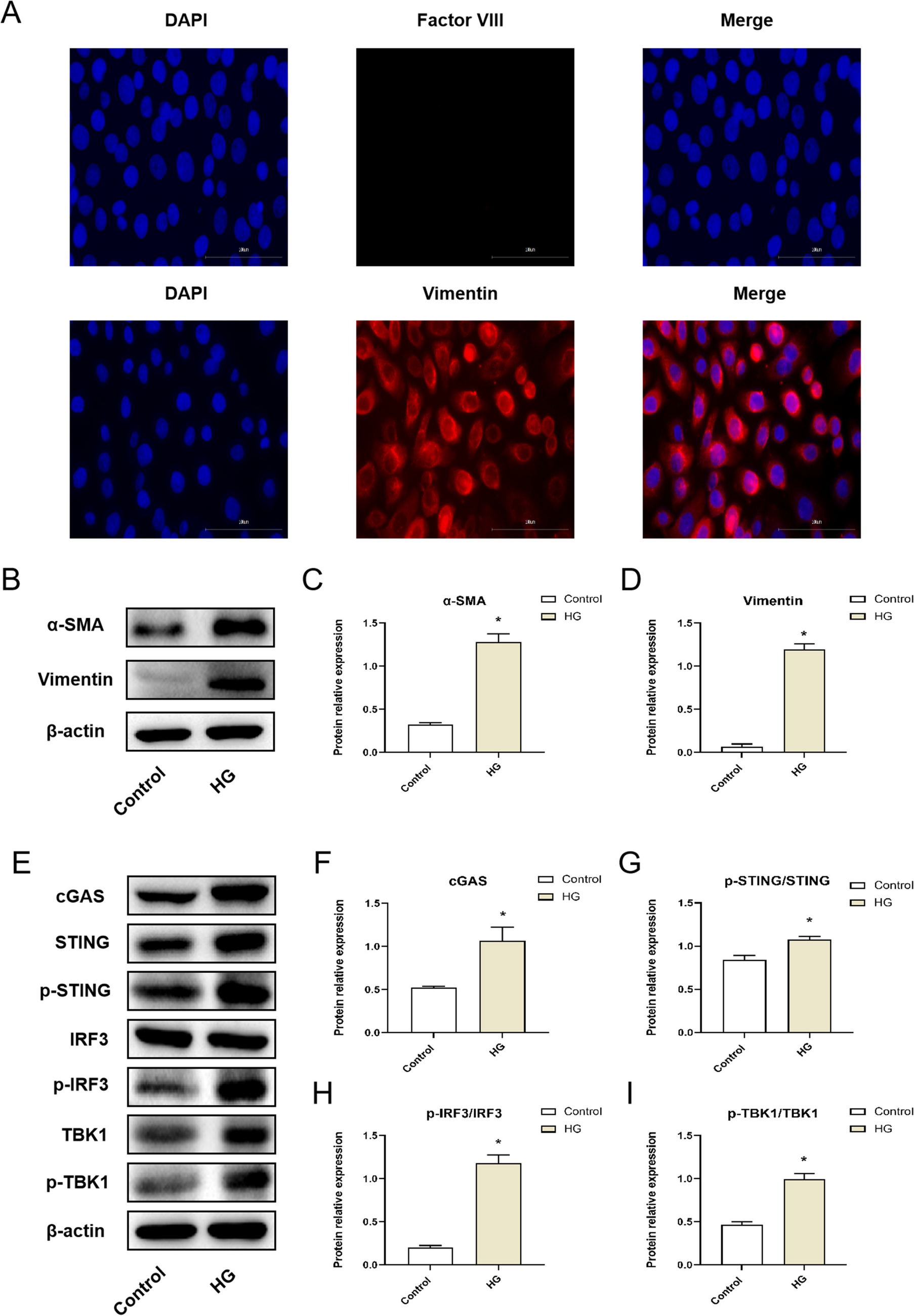 Inhibition of cGAS-STING signaling pathway alleviates high glucose-induced mesothelial-mesenchymal transition in human peritoneal mesothelial cell line HMrSV5