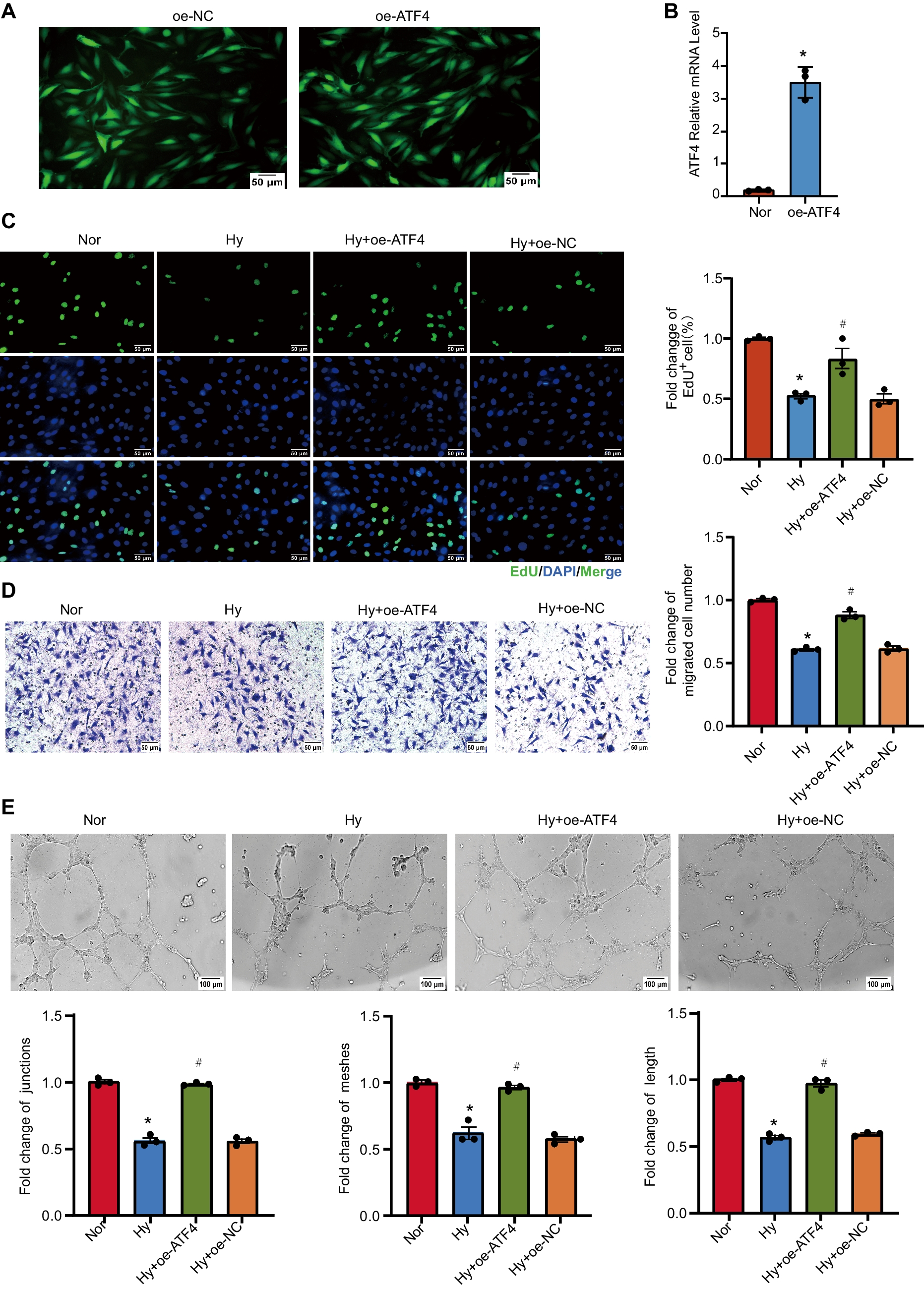 ATF4 regulates PI3K/AKT signaling axis to promote angiogenesis after myocardial infarction