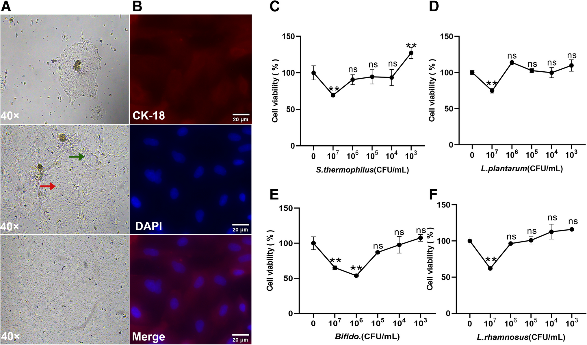 promotes lactoferrin synthesis and secretion in bovine mammary epithelial cells through STAT3 and AP-1 transcription factor pathways