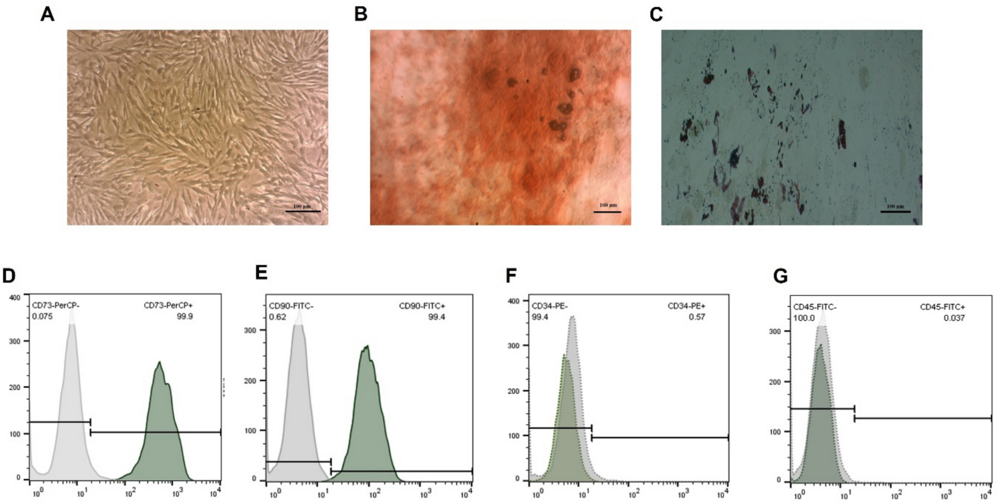 Therapeutic potential of miR-10a overexpressing mesenchymal stem cell–derived extracellular vesicles in modulating inflammation in collagen-induced arthritis