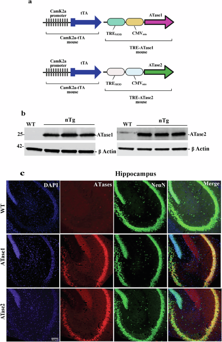 Increased expression of ATase1/NAT8B or ATase2/NAT8 in the mouse results in an autistic-like phenotype with altered dendritic branching and spine formation
