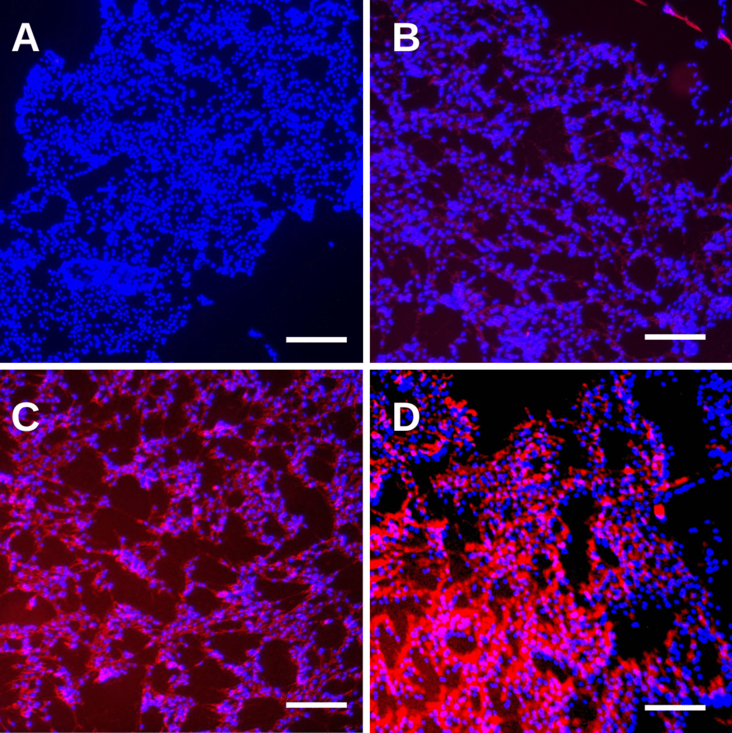 Treating Post-Cataract Posterior Capsule Opacification: The Relationship Between Myofibroblast Concentration on Lens Capsule Wrinkling