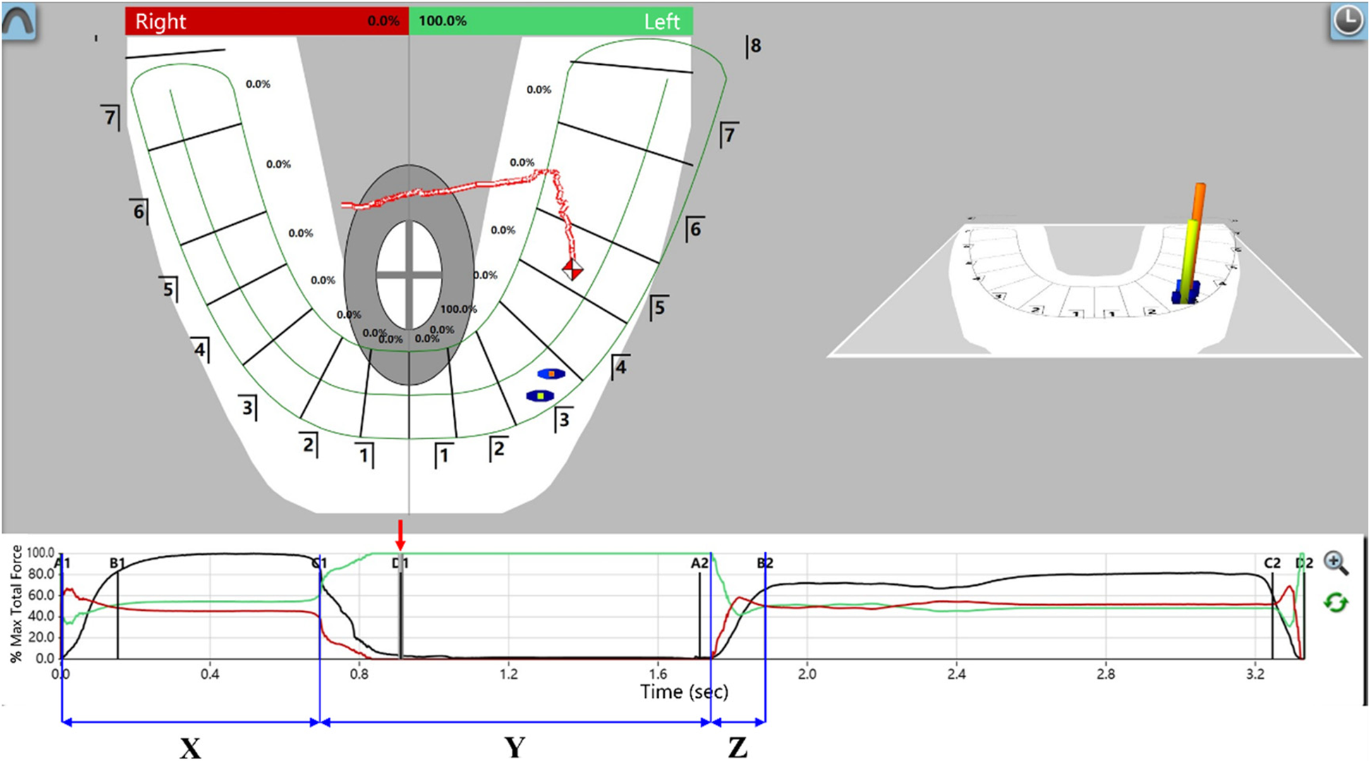 Clinical investigation of the correlation between tooth wear and dynamic functional occlusal condition in Chinese cohort