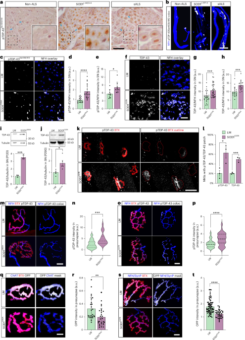 Muscle-derived miR-126 regulates TDP-43 axonal local synthesis and NMJ integrity in ALS models