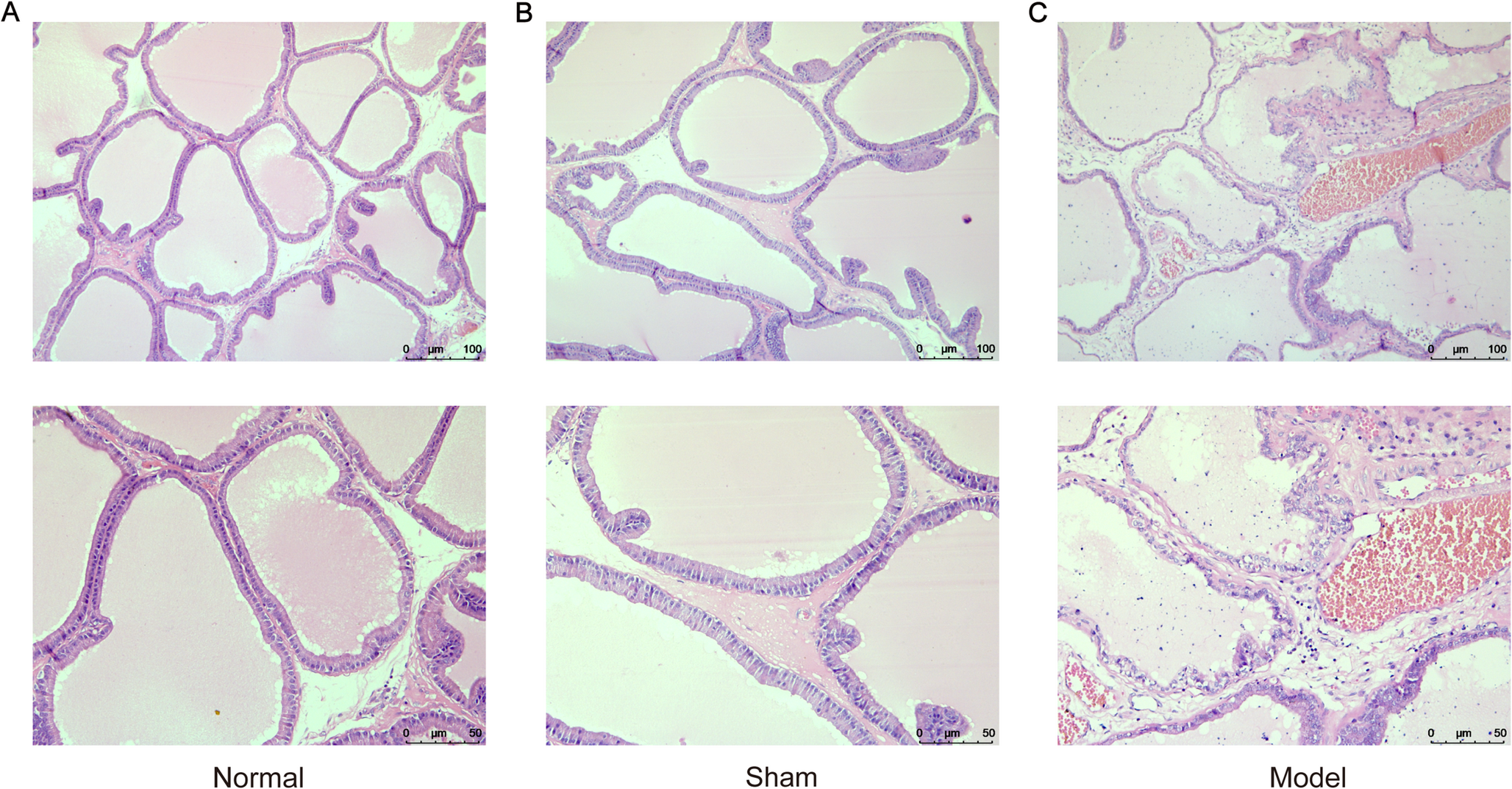 Expression and regulation network of BLNK in CP/CPPS in animal, cell model and clinical samples