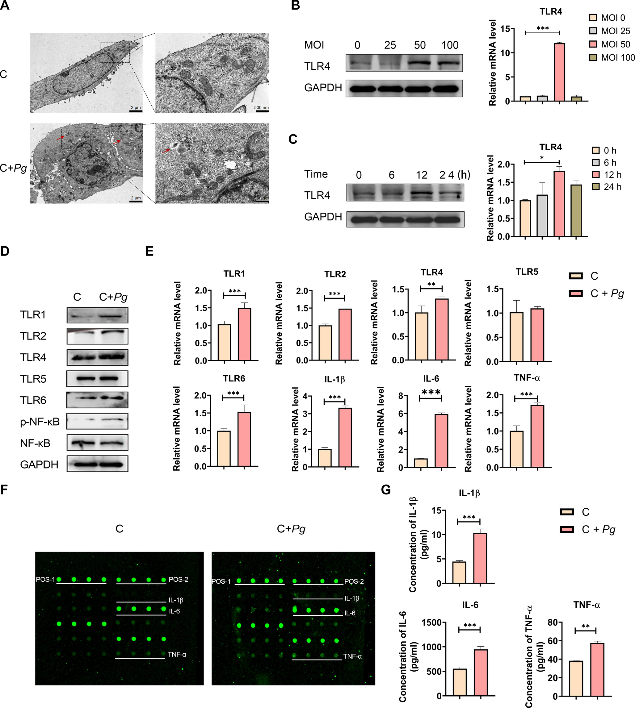 Inactivated  R0179 Inhibits -Induced Gingival Inflammation Via TLR2/NF-κB Signaling in a Murine Model of Periodontitis