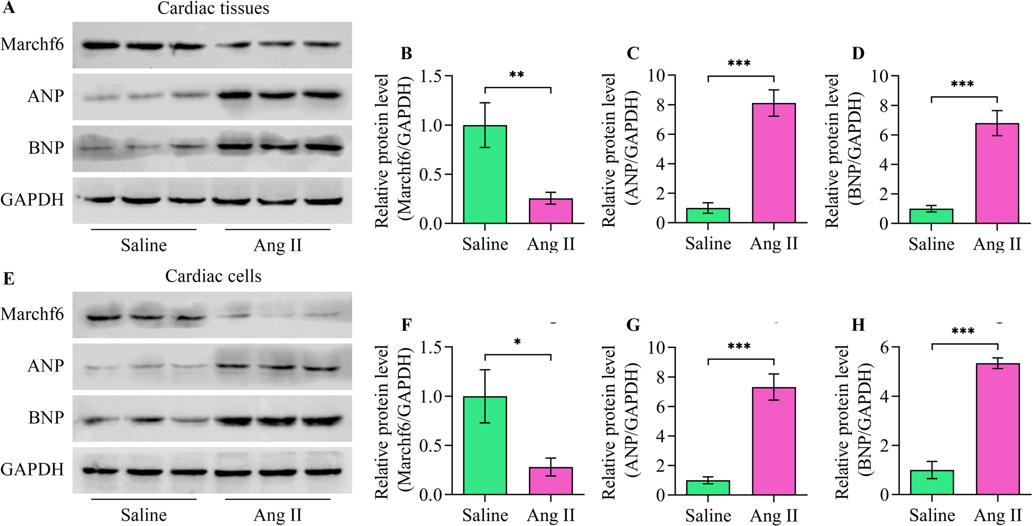 Membrane-Associated RING-CH-Type Finger 6 Protects against Hypertension-Induced Cardiac Remodeling by Suppressing Cardiomyocyte Ferroptosis Through the Degradation of ACSL4