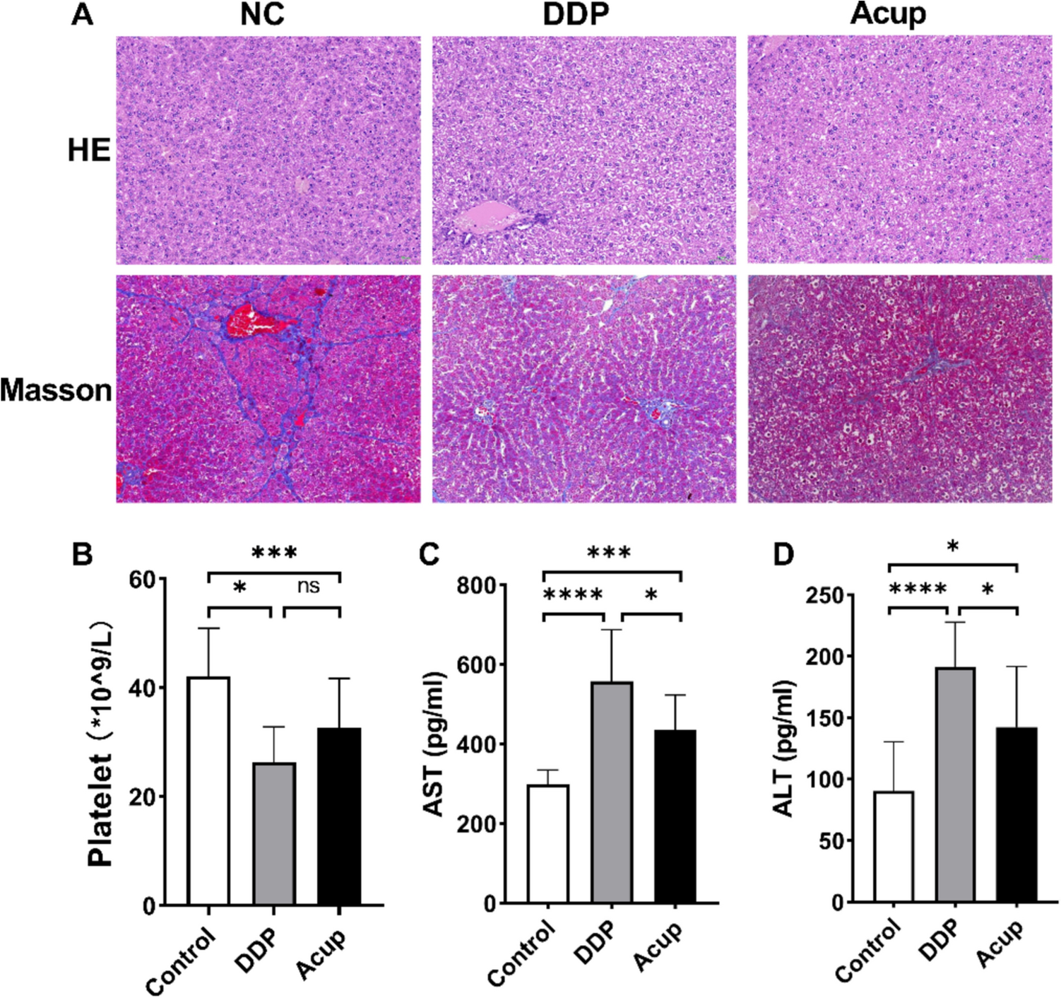 Acupuncture ameliorates liver injury induced by platinum treatment through the Notch signaling pathway