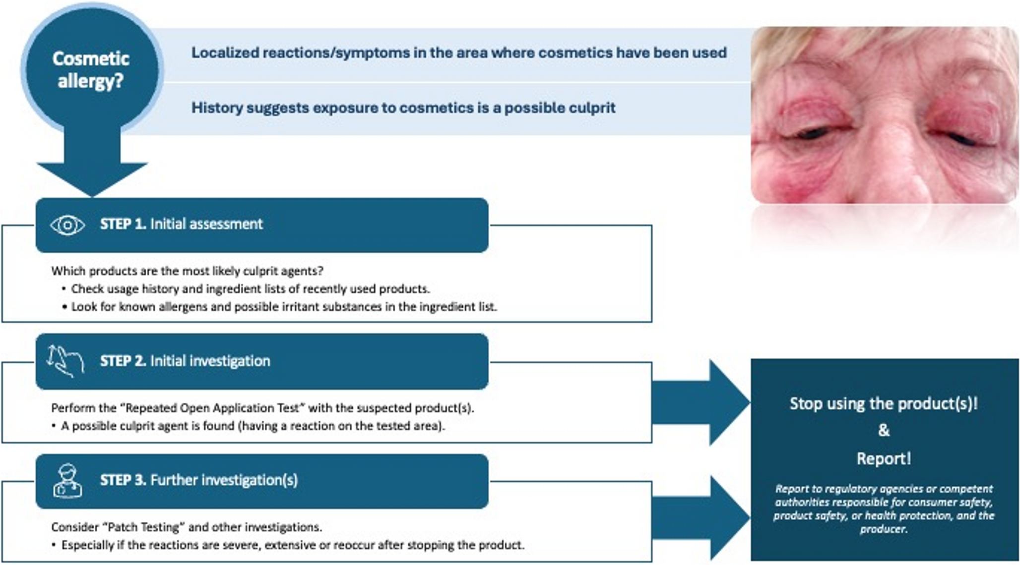 What is New in Contact Allergy To Cosmetics for Physicians, Cosmetologists, and Cosmetic Users?