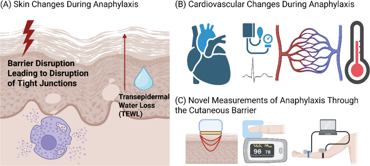 Detection of Anaphylaxis Through the Cutaneous Barrier