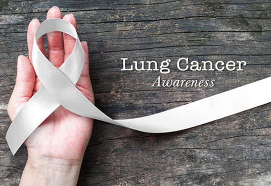 Cancer center offers Lung Cancer Screening Day on Sat., Nov. 8