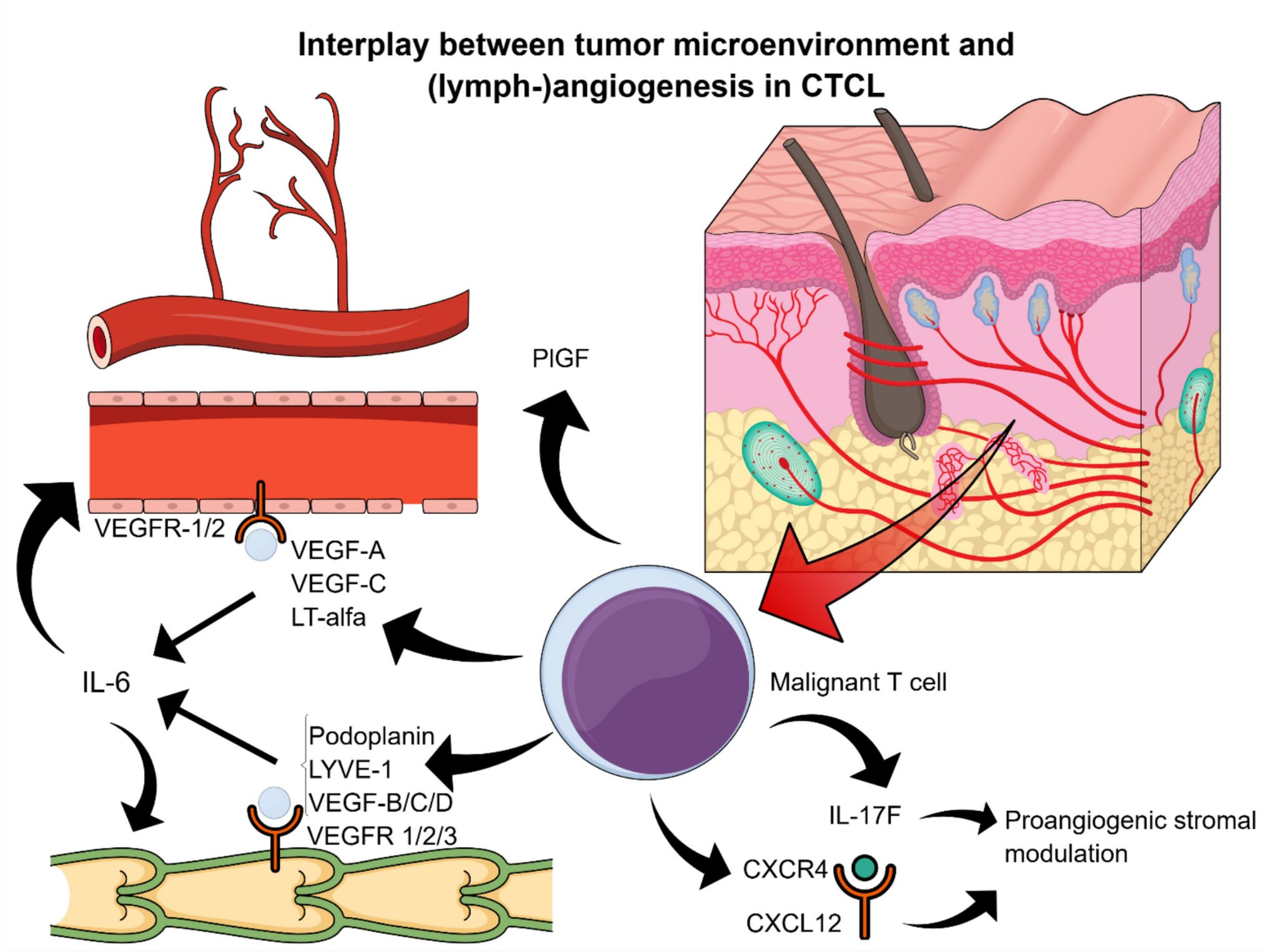 Angiogenesis and lymphangiogenesis in primary cutaneous lymphomas: a narrative review