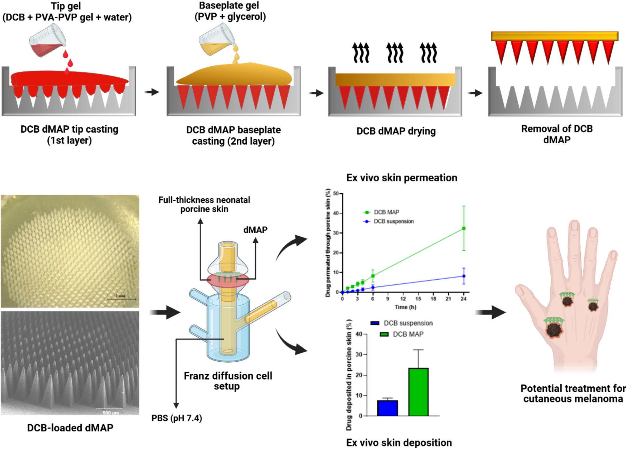 Dacarbazine-loaded Bilayer Dissolving Microneedle Array Patch for Localized Delivery in Cutaneous Melanoma