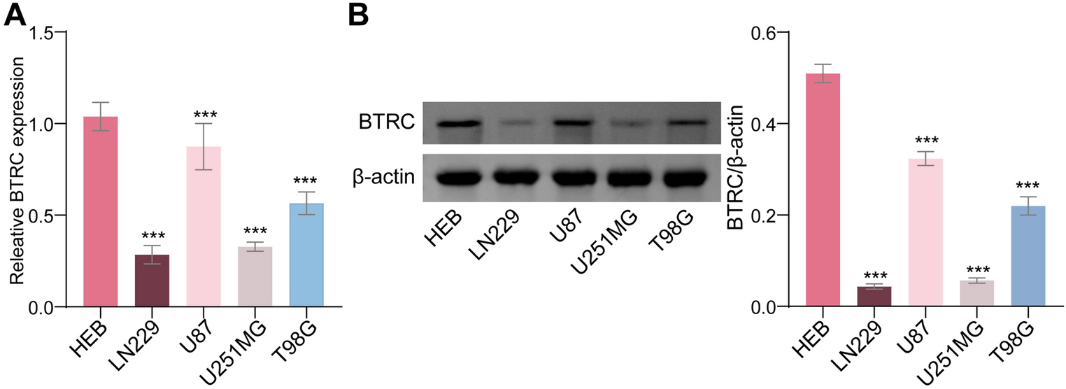 E3 ubiquitin ligase BTRC inhibits the proliferation and tumor growth of glioma cells through the NFAT5/AQP4 axis
