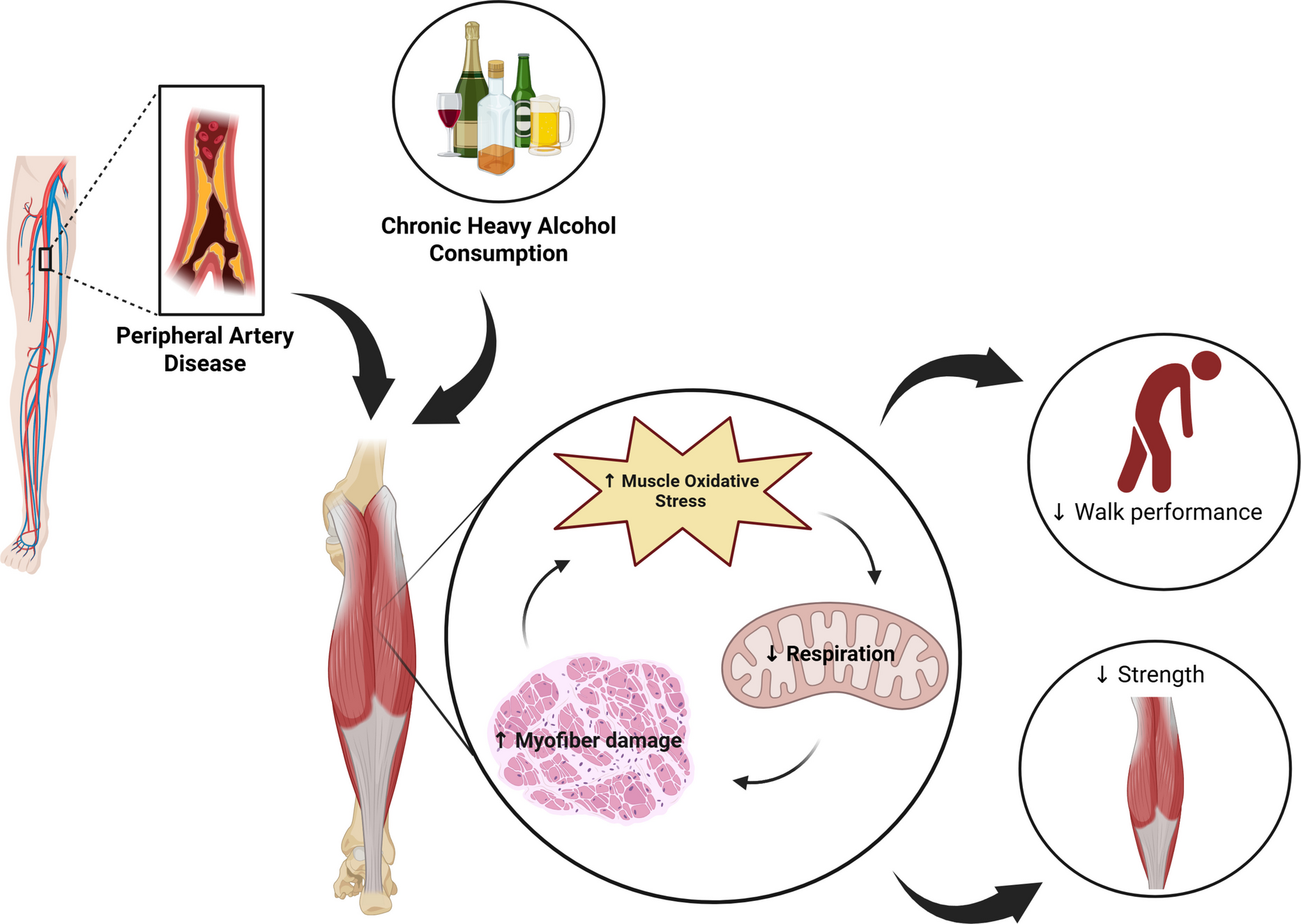 Heavy alcohol use exacerbates skeletal myopathy in peripheral artery disease