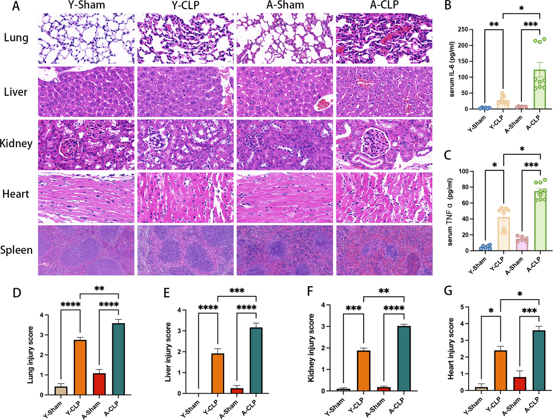 Single-cell transcriptomic analysis reveals immune remodeling in bone marrow during aged sepsis