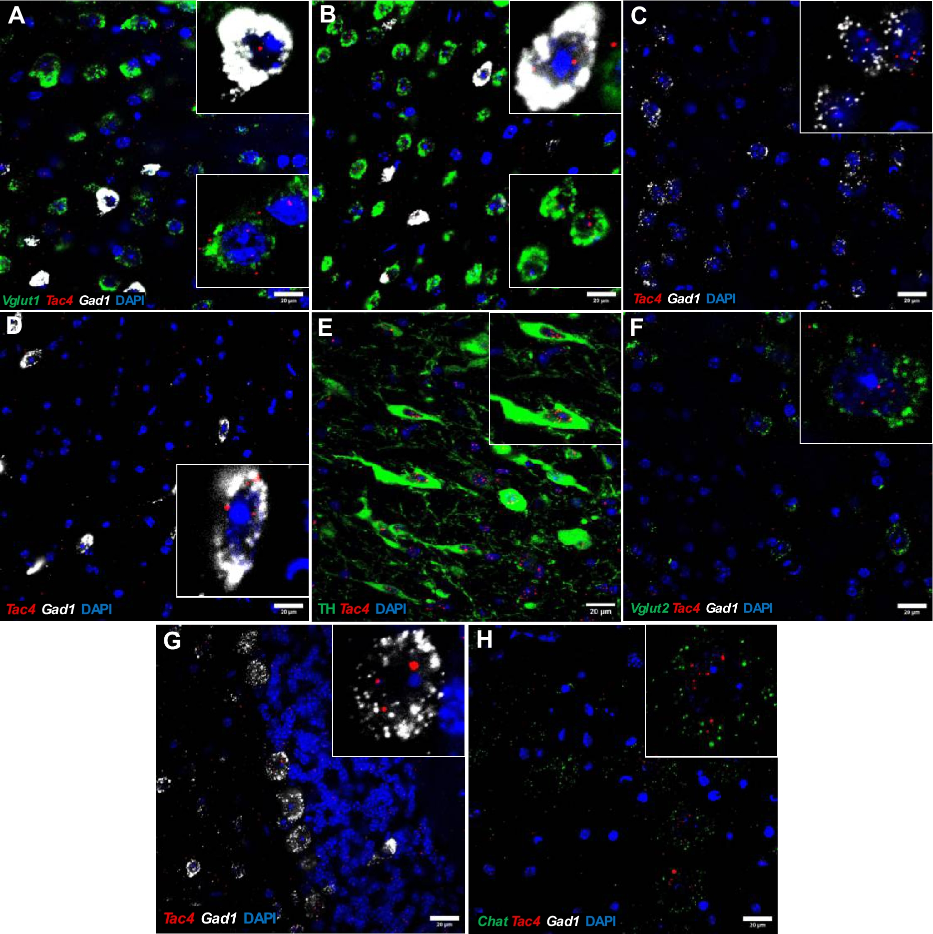 Widespread neuronal hemokinin-1 expression in motor regions and its protective role in age-related impairment