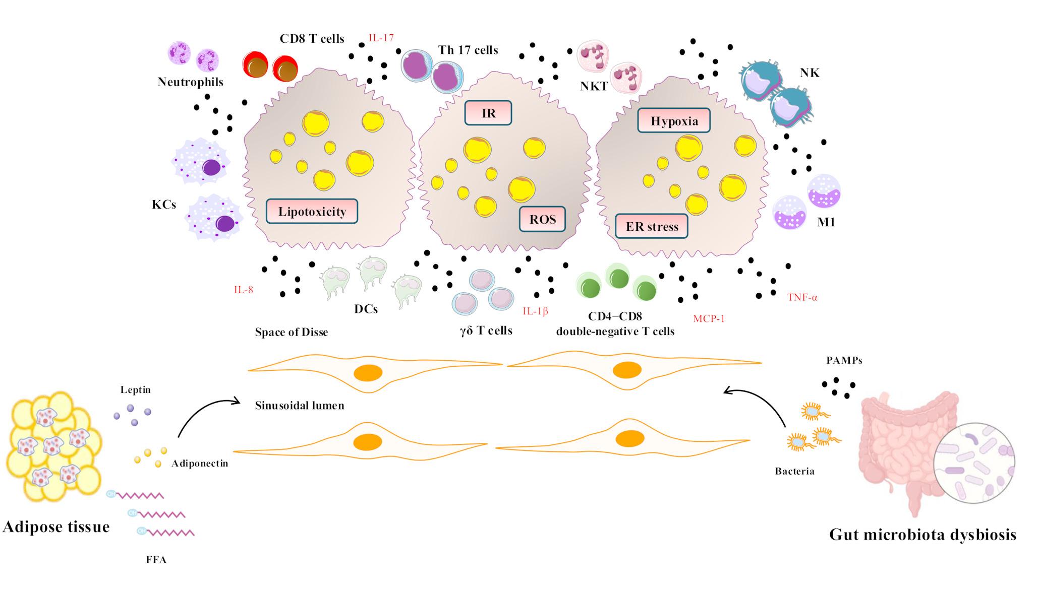 The Intriguing Roles of Cytokines in Metabolic Dysfunction-Associated Steatotic Liver Disease: A Narrative Review