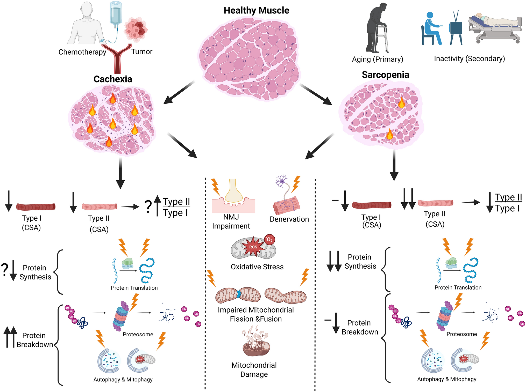 Sarcopenia and Cachexia in Older Patients with Cancer: Pathophysiology, Diagnosis, Impact on Outcomes, and Management Strategies