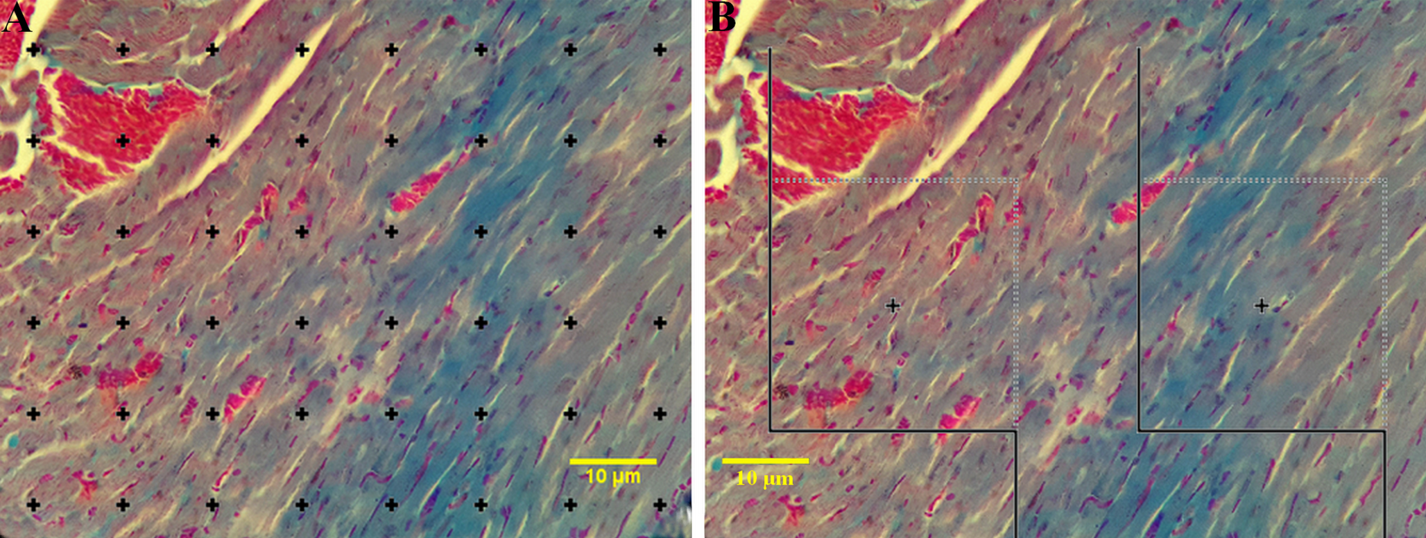 Protective effects of  and  on cardiac gene expression (, ) and structural alterations in a  mouse model of MASLD