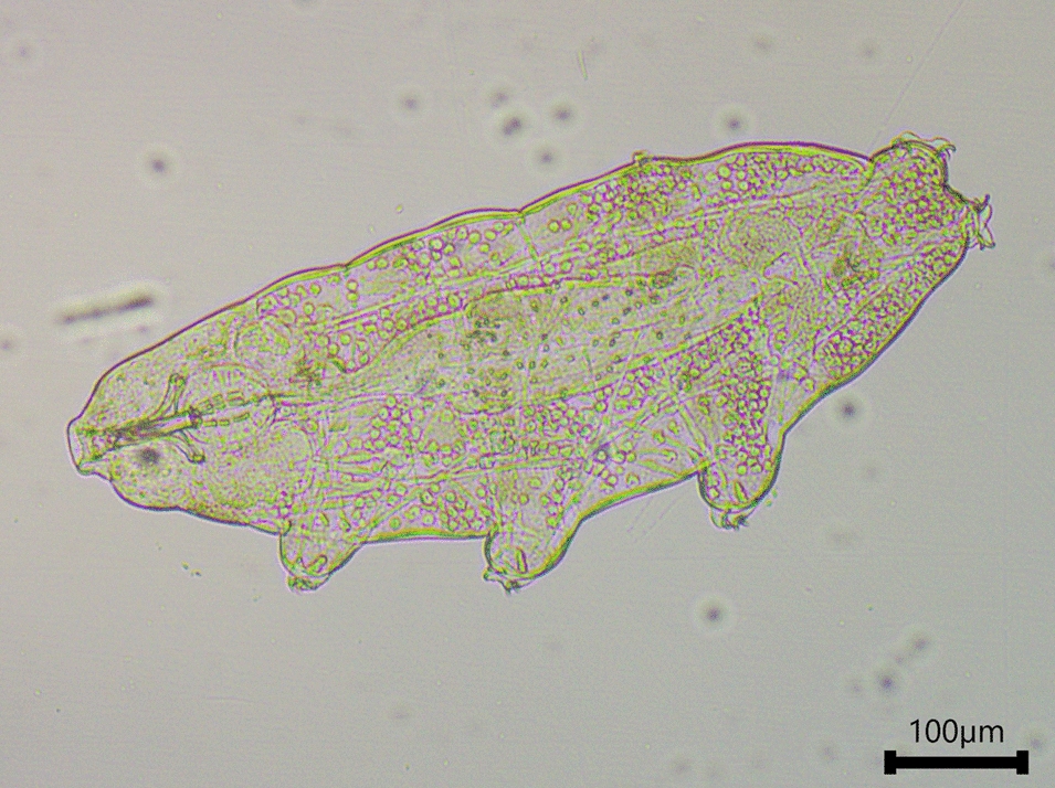 Surviving deadly radiation: Lessons from tardigrades