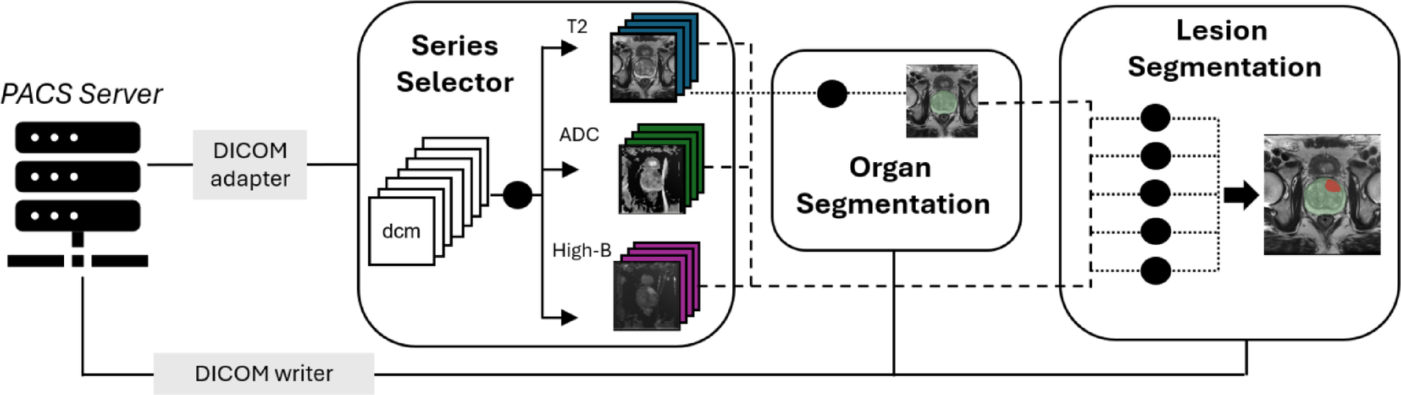 Research-based clinical deployment of artificial intelligence algorithm for prostate MRI