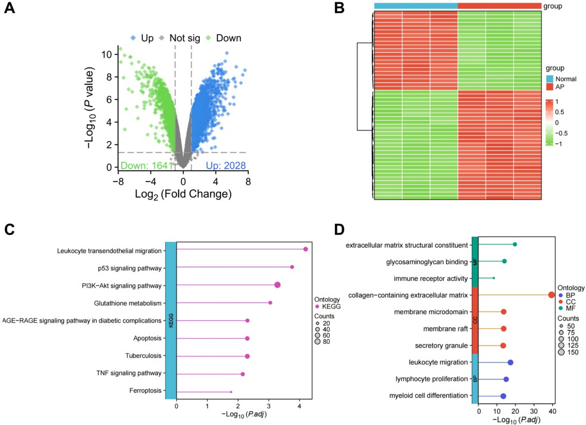 Mechanistic Investigation of FBXW11-Mediated Ubiquitination and Degradation of HIC1 in Regulating IRF1 Transcription and Accelerating Acute Pancreatitis Progression