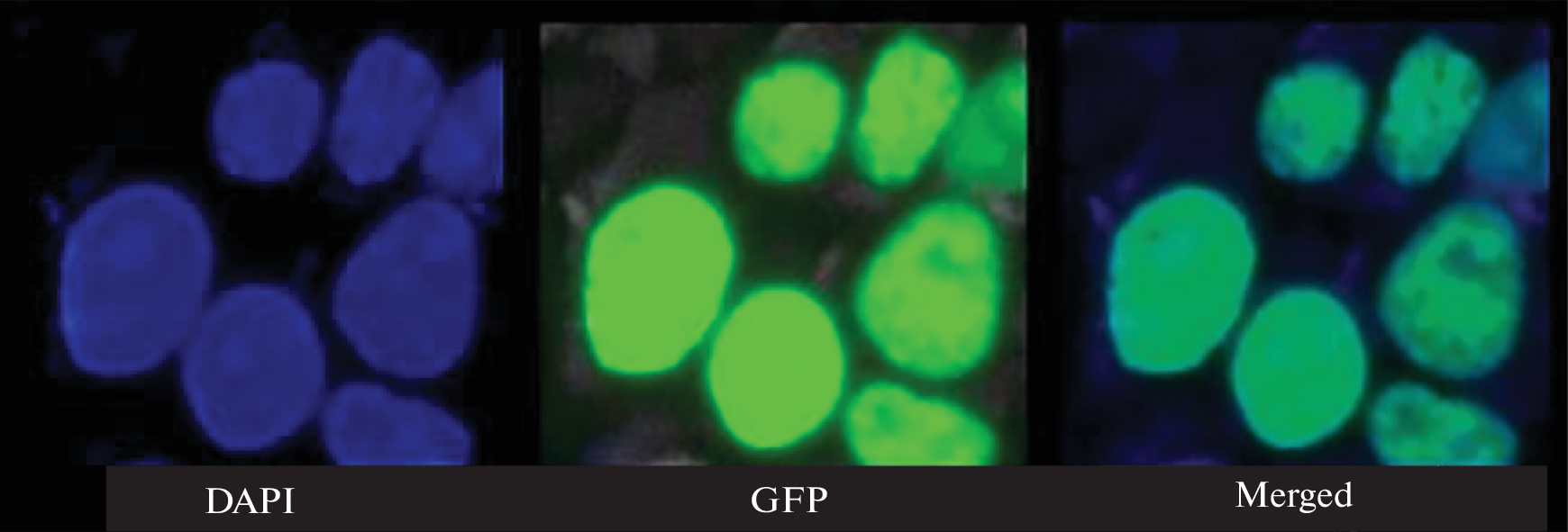 Tardigrade Dsup Protein Protects Human Cells during Proton Radiotherapy