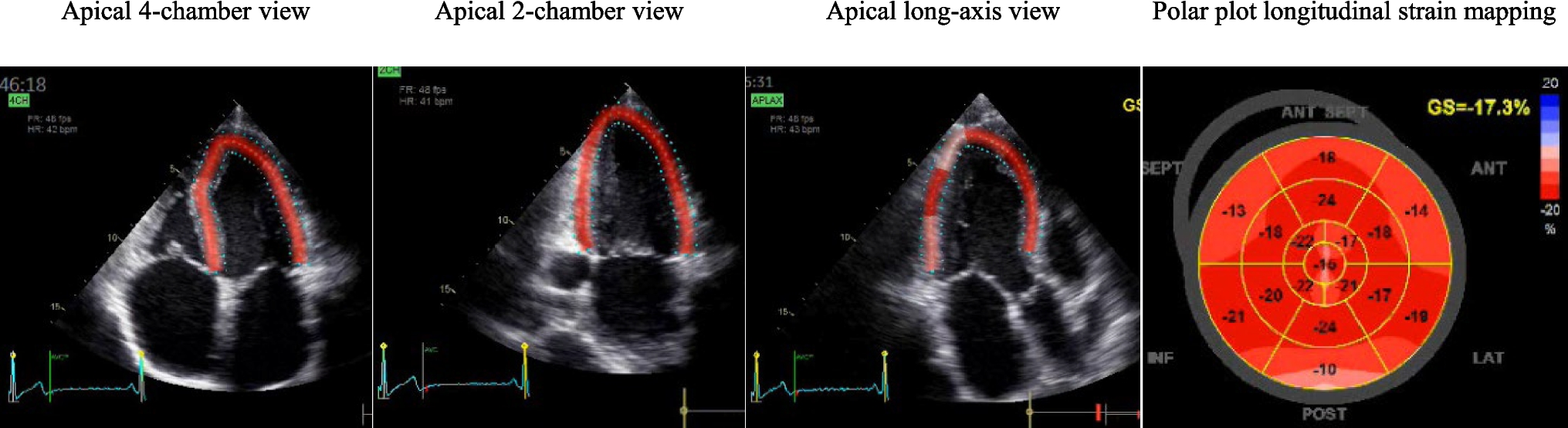 Evolving role of echocardiography across the heart failure spectrum: from prevention to advanced management