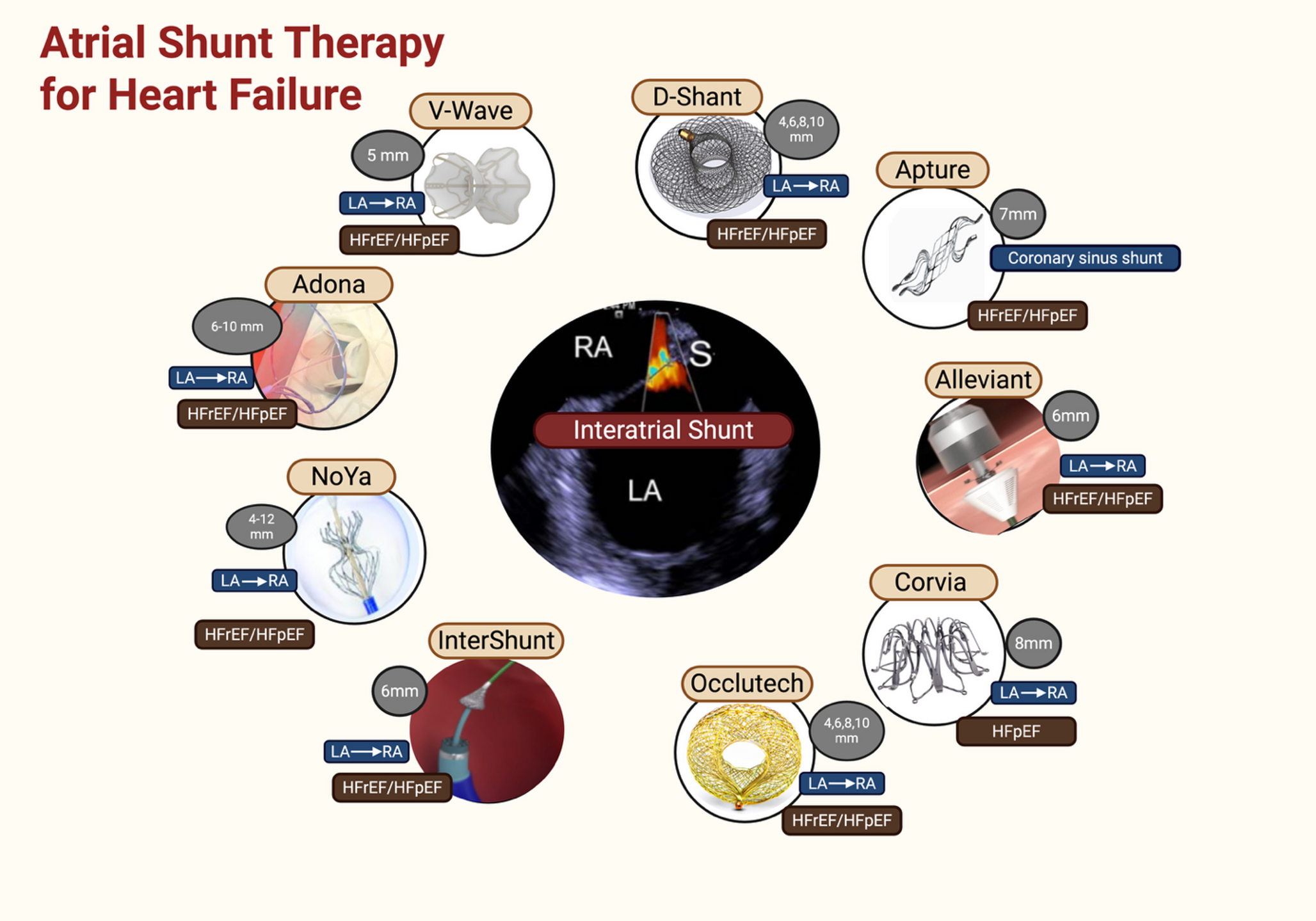 Atrial shunt therapy for heart failure: an update review