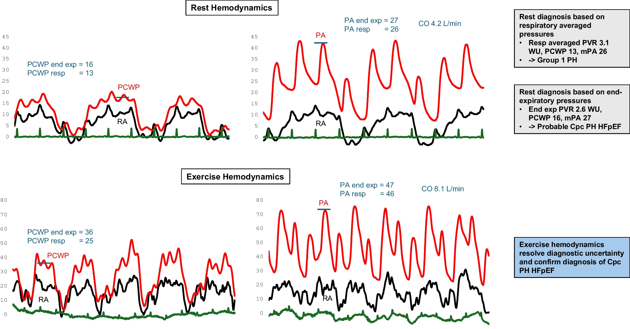 Evaluation of pulmonary hypertension in heart failure with preserved ejection fraction