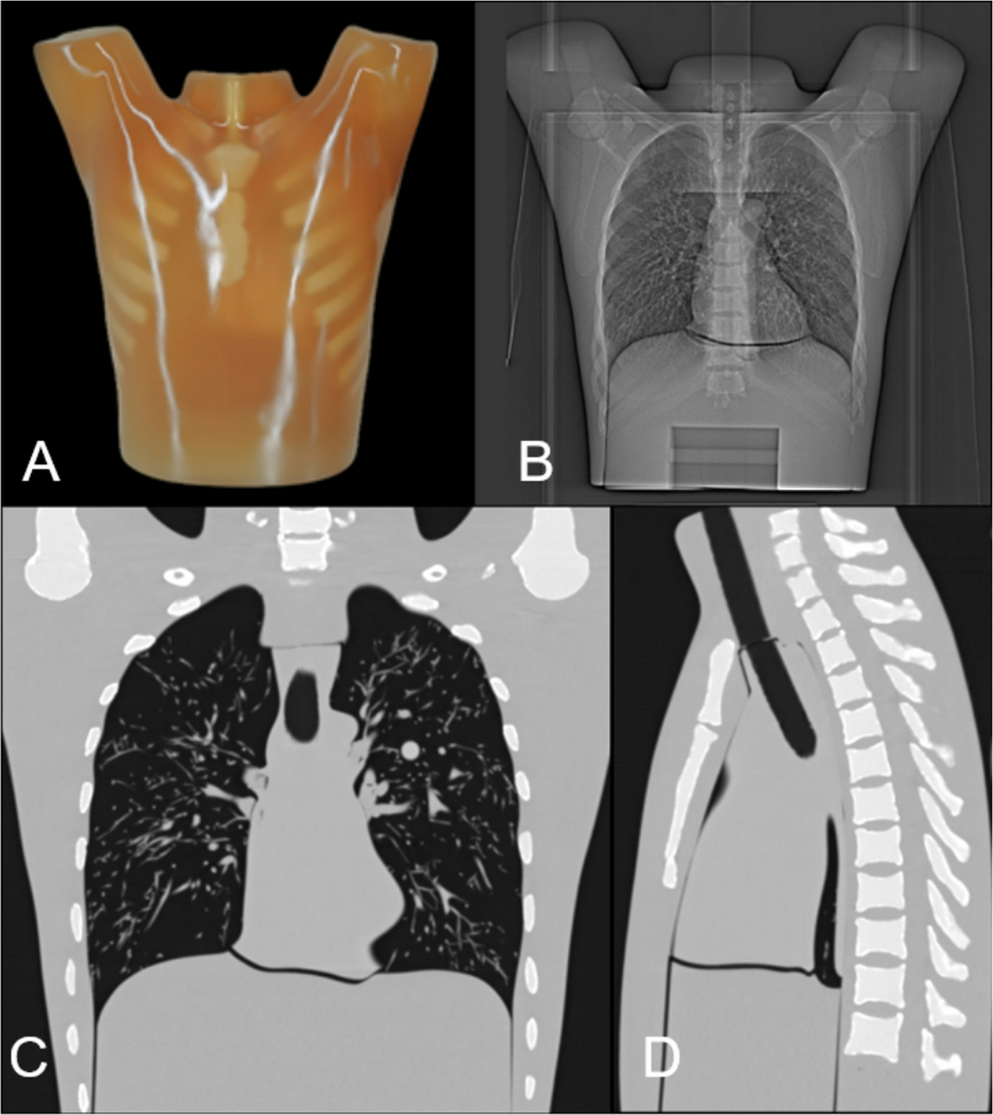 Comparative image quality evaluation of unenhanced postmortem Photon-Counting CT and Energy-Integrating CT