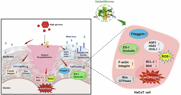 Umbelliferone preserves skin epidermal barrier integrity in diabetes-induced keratinocytes by regulating actin dynamics and suppressing ROS-mediated apoptosis