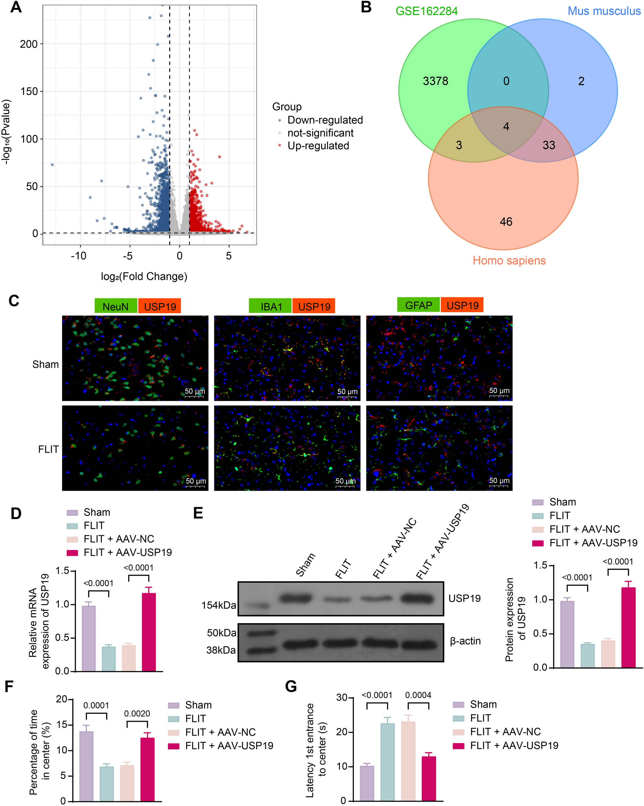 USP19 restores mitochondrial function in neurons by deubiquitinating FUS to alleviate trigeminal neuralgia