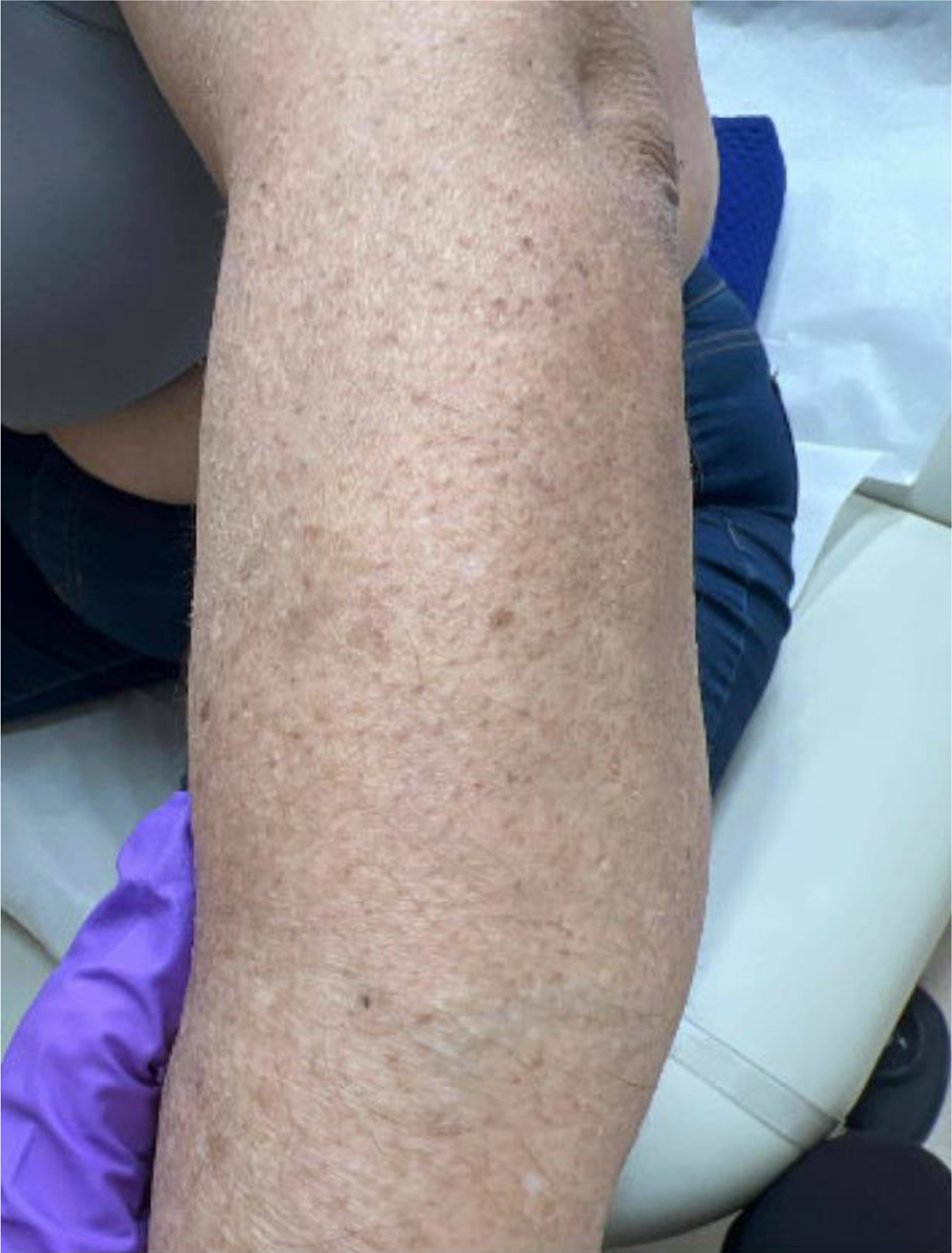 A Review on Nutritional Deficiencies for the Inpatient Onco-Dermatologist